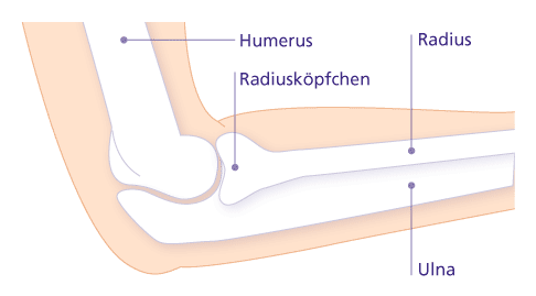 Drei Knochen bilden das sehr komplexe Ellenbogengelenk: Der Oberarmknochen (Humerus) ist verbunden mit Elle (Ulna) und Speiche (Radius) des Unterarms. Häufig wird der unten herausstehende Fortsatz der Elle (Olekranon) als Ellenbogen bezeichnet. Das eigentliche Ellenbogengelenk ist aber das gelenkige Zusammentreffen der drei Knochen, das von einer gemeinsamen Gelenkkapsel umgeben ist. © Gelenk-Klinik. Anatomie des Radiusköpfchens