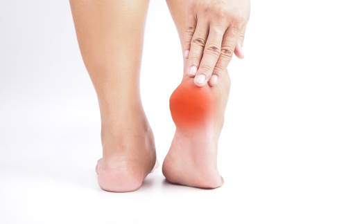 Der untere Fersensporn und die meist zugrundeliegende Plantarfasziitis machen sich durch Fußschmerzen an der Fußsohle bemerkbar. © Tanapat Lek,jew, Adobe Stock Fersenschmerzen durch unteren Fersensporn