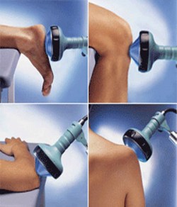 Stoßwellentherapie wird bei Fersensporn und Plantarsehnenentzündung und auch bei zahlreichen anderen Senenansatzentzündungen erfolgreich eingesetzt. Stoßwellentherapie bei Fersensporn und Plantarsehnenentzündung