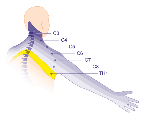 Jeder Spinalnerv der Halswirbelsäule versorgt eine bestimmte Armregion mit sensorischen und motorischen Impulsen. Anhand der Schmerzen und Missempfindungen in einem Dermatom und den Ausfallerscheinungen beim Patienten kann der Arzt auf das betroffene Segment der Halswirbelsäule schließen. © Gelenk-Klinik Darstellung der Armregionen, die von bestimmten Spinalnerven der Halswirbelsäule versorgt werden.
