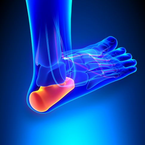 Das Fersenbein (Calcaneus) bildet mit dem Sprungbein (Talus) den hinteren Teil des Fußes, den sogenannten Rückfuß. Schmerzen am Fersenbein können vielfältige Ursachen haben und machen sich als Fersenschmerzen bemerkbar. © decade3d/stock.adobe.com Fersenschmerzen haben ihren Ursprung am Fersenbein