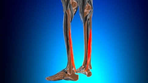 Die natürliche Aufgabe des Großzehenbeugers (M. flexor hallucis longus, rot) ist die Beugung der großen Zehe. Verlagert man seine Sehne und befestigt sie am Fersenbein, führt die Anspannung des Muskels zur Beugung des Fußes im Sprunggelenk. Das entlastet eine chronisch geschädigte Achillessehne und unterstützt diese bei ihrer Heilung. © mybox, Adobe Schematische Darstellung des M. flexor hallucis longus