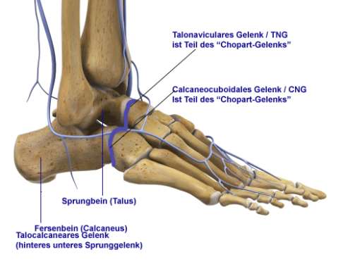 Die vorderen Anteile des unteren Sprunggelenks bestehen aus dem talonavikularen und dem calcaneocuboidalen Gelenk. Das so zusammengefasste Chopart-Gelenk (blaue Linie) hat großes Potential, bei einer Versteifung des oberen Sprunggelenks einen großen Teil der Beweglichkeit des Fußes (Heben und Senken) zu übernehmen. © Viewmedica Anatomie des Fußes mit Chopart-Gelenk