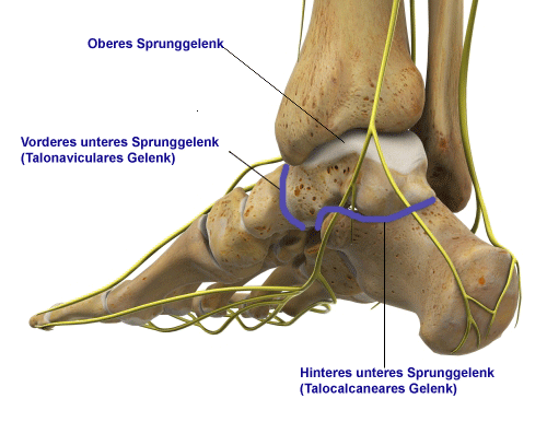 Blau eingezeichnet sind die beiden Gelenke des unteren Sprunggelenks, die bei einer Double-Arthrodese versteift werden: Das talocalcaneare Gelenk zwischen Sprungbein und Fersenbein und das Talonavikulargelenk zwischen Sprungbein und Kahnbein. © Dr. Thomas Schneider Blau eingezeichnet sind die beiden Gelenke des unteren Sprunggelenks, die bei einer Double-Arthrodese versteift werden.