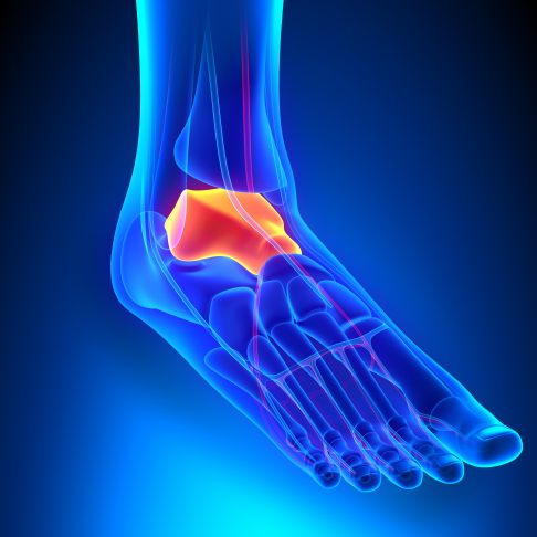 Anatomische Lage des Sprungbeins (Talus) im Fuß. Der Talus nimmt eine zentrale Funktion bei der Kraftübertragung vom Unterschenkel auf Rückfuß und Vorfuß ein. Die gesamte Kraft wird vom Unterschenkel über den Talus in den Fuß geleitet. Der Talus ist dabei die höchste Stelle des Fußes. Die Kräfte werden hierbei abhängig von der Fußstellung und der Phase im Gangzyklus jeweils anders verteilt. © decade3d, Adobe Lage des Sprungbeins (Talus)
