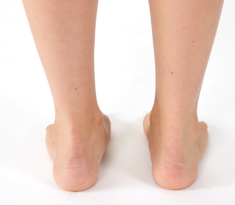 Bewusste Regulierung der Fersenstellung. © Gelenk-Klinik Bewusste Regulierung der Fersenstellung