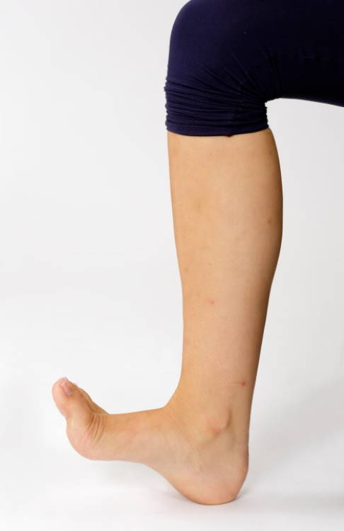 Variante: Sie können die Übung auch einbeinig durchführen. © Gelenk-Klinik Übung mit dem Therapiekreisel: einbeinig