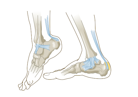 Im Bereich der Ferse befindet sich ein Schleimbeutel. Entzündet er sich, ist ein schmerzfreies Gehen im Schuh fast nicht mehr möglich. © Axel Kock, Adobe Anatomie des Fußes und der Ferse mit Schleimbeutel an der Achillessehne