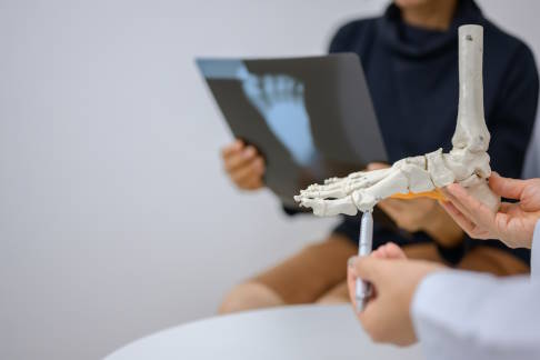 Eine operative Behandlung von Problemen im Vorfuß kann Schmerzen lindern, wenn konservative Maßnahmen an ihre Grenzen stoßen. © เลิศลักษณ์ ทิพชัย, Adobe Arzt erklärt dem Patienten seine Diagnose anhand eines Fußmodells