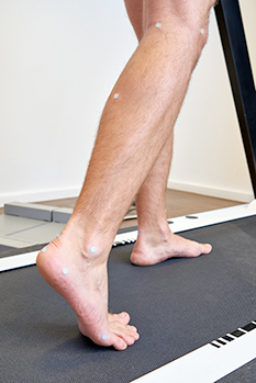 Verschiedene Winkelmessungen an der Körperoberfläche an markanten Punkten der Bewegungsorgane tragen zur Diagnose des Bewegungsablaufs bei. © Gelenk-Klinik Winkelmessung bei der Ganganalyse