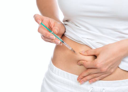 Viele Diabetiker führen das Insulin durch subkutane Injektionen zu. © Dmitry Lobanov, Adobe Frau führt eine subkutane Injektion in den Bauch durch.