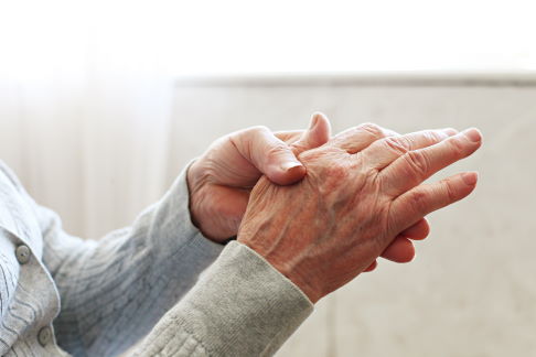 Patienten mit Rhizarthrose leiden unter Schmerzen und verminderter Beweglichkeit im Daumengelenk. © Evrymmnt, Adobe Rhizarthrose
