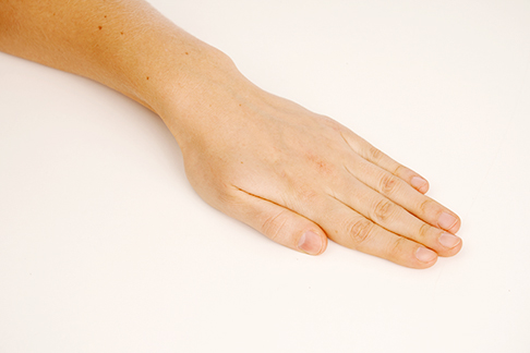 Ausgangsstellung: Die Hand liegt flach auf dem Tisch. © Gelenk-Klinik Ausgangsstellung