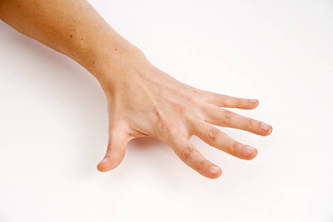 Öffnen Sie die Hand wieder und strecken Sie die Finger maximal. © Gelenk-Klinik Hand öffnen