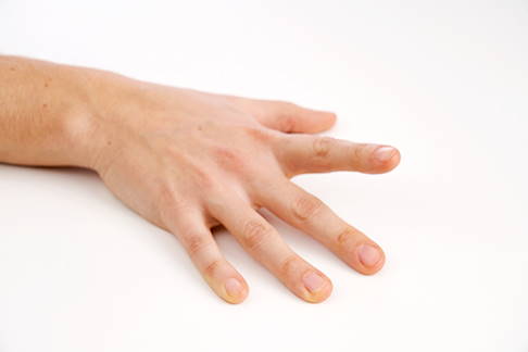 Fingermobilisation Zeigefinger. © Gelenk-Klinik Fingermobilisation Zeigefinger