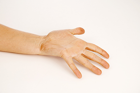 Bringen Sie die Finger in Streckung, um die Tischplatte zu berühren. © Gelenk-Klinik Finger strecken