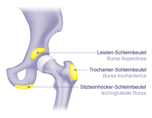 Die Schleimbeutel am Hüftgelenk schützen umliegende Strukturen vor mechanischer Reizung. © Gelenk-Klinik Schleimbeutel (Bursae) des Hüftgelenks