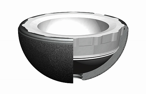 Die Gelenkpfanne der Hüftprothese besteht aus einer Metallkomponente, die in das Acetabulum (Hüftpfanne) eingesetzt wird, und einem Inlay, das den Femurkopf (Oberschenkelkopf) aufnimmt. © Smith & Nephew Hüftpfanne der Hüftendoprothese