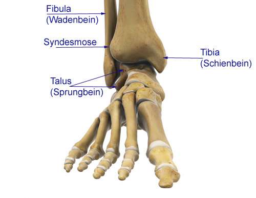 Anatomie des Sprunggelenks von vorne: Drei Knochen bilden das Sprunggelenk: Tibia (Schienbein) und Fibula (Wadenbein) gleiten über den Talus (Sprungbein). Jede schmerzhafte Einschränkung der Sprunggelenksbeweglichkeit vorne (anterior), hinten (posterior oder dorsal) oder seitlich (lateral) wird als Sprunggelenksimpingement bezeichnet. © Viewmedica Sprunggelenk-Impingement