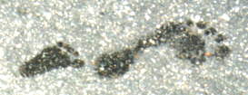 Der Fußabdruck des Kleinkinds mit kaum vorhandenem Fußgewölbe weist nur scheinbar auf eine Fehlstellung hin. Dies beruht oft auf ausgeprägten Fettpölsterchen und Babyspeck an der Fußsohle. ©Wikipedia Fußabdruck eines Kleinkindes. Sichtbar ist das ausgefüllte Fußgewölbe des Kindes im Vergleich zur Mutter.