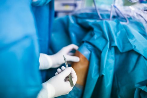 Bei wiederholter Patellaluxation kann der Kniespezialist die Kniescheibe mit einer MPFL-Plastik stabilisieren. Der minimalinvasive Eingriff erfolgt in Vollnarkose oder Spinalanästhesie.© lightpoet, adobe.com MFL-Plastik-Operation