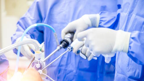 Die minimalinvasive Vorgehensweise während der Knieoperation schont das Gewebe und ermöglicht dem Patienten eine frühe Beweglichkeit und Schmerzfreiheit. © Issara, Adobe minimalinvasive Knieoperation