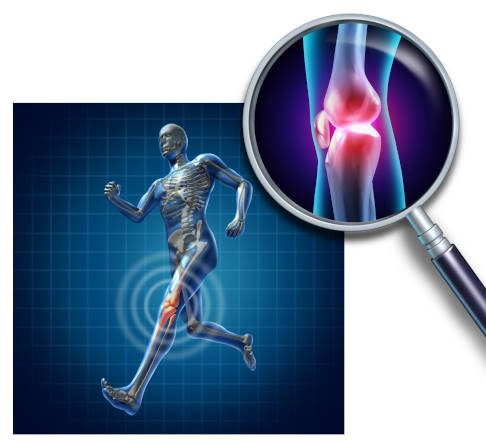 Beschreiben Sie dem Orthopäden genau, wo die Schmerzen lokalisiert sind und in welcher Situation das Knie schmerzt. © freshidea, Adobe Symptomchecker bei Knieschmerzen