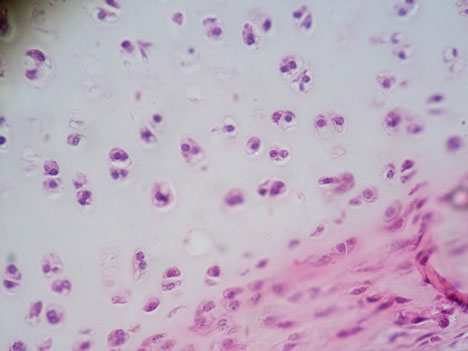 Hyaliner Gelenkknorpel unter dem Mikroskop: Zur besseren Sichtbarkeit wurden die Chondrozyten (Knorpelzellen) angefärbt. © Ganimedes über Wikimedia.org Hyaliner Gelenkknorpel unter dem Mikroskop