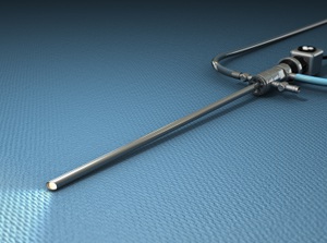 Das Arthroskop besteht aus einer in einem dünnen Stab eingebrachten Lichtquelle, die das Innere des Kniegelenks ausleuchtet und einer Kamera, die Bilder aus dem Kniegelenk auf einen Bildschirm im Operationssaal projiziert. © Viewmedica Aufbau eines Arthroskops