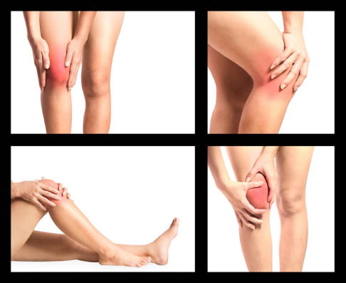 Eine Schleimbeutelentzündung im Knie führt zu Schmerzen und Schwellungen. Das Knie fühlt sich überwärmt an und in einigen Fällen ist eine Rötung von außen direkt sichtbar. © angkhan @ iStock Knie mit Rötung und Schwellung