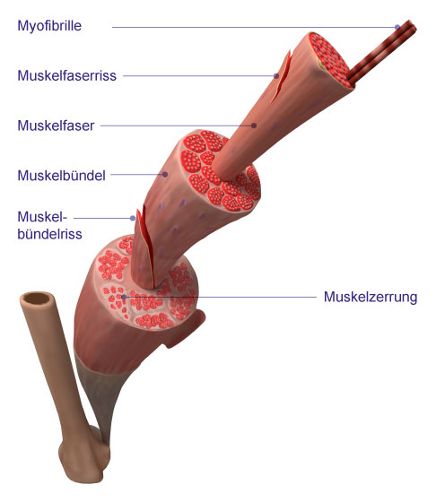 Der Muskel besteht aus einzelnen Muskelfasern, die zu Muskelbündeln zusammengefasst sind. © Sebastian Kaulitzki, Adobe Muskelaufbau, grafische Darstellung