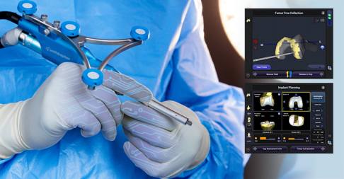 Sowohl bei der Planung einer Operation wie auch bei der Durchführung unterstützen computergesteuerte Handstücke und die spezielle NAVIO-Software den Operateur. Mit freundlicher Genehmigung von Smith&Nephew. computergesteuertes Handstück