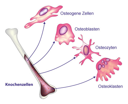 Die vier verschiedenen Zellen des Knochens: Aus den Osteogenen Zellen entwickelt sich der knochenbildende Osteoblast. Osteonlasten können zu ruhenden Osteozyten werden, die in der Knochenmatrix sitzen und von dort den Knochenstoffwechsel regulieren. Die knochneabbauenden Osteoklasten entstehen aus Zellen des Knochenmarks. © KKT Madhusanka, Adobe Verschiedene Formen der Knochenzellen