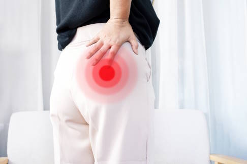 Das Piriformis-Syndrom verursacht Schmerzen im unteren Rücken und im Gesäß, die bis in die Beine ausstrahlen können. © doucefleur, Adobe Frau mit Piriformis-Syndrom leidet an Schmerzen im unteren Rücken und im Gesäß.