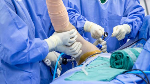 Die minimalinvasive Vorgehensweise während der Schulteroperation schont das Gewebe und ermöglicht dem Patienten eine frühe Beweglichkeit und Schmerzfreiheit. © Issara, Adobe minimalinvasive Schulteroperation