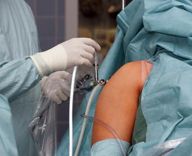 Eine arthroskopische Operation der Schulter kann die Enge unter dem Schulterdach beseitigen und die Beweglichkeit des Schultergelenks verbessern. Hierfür sind nur minimale Hautschnitte erforderlich. © smartmediadesign, Fotolia Schulteroperation Arthroskopie