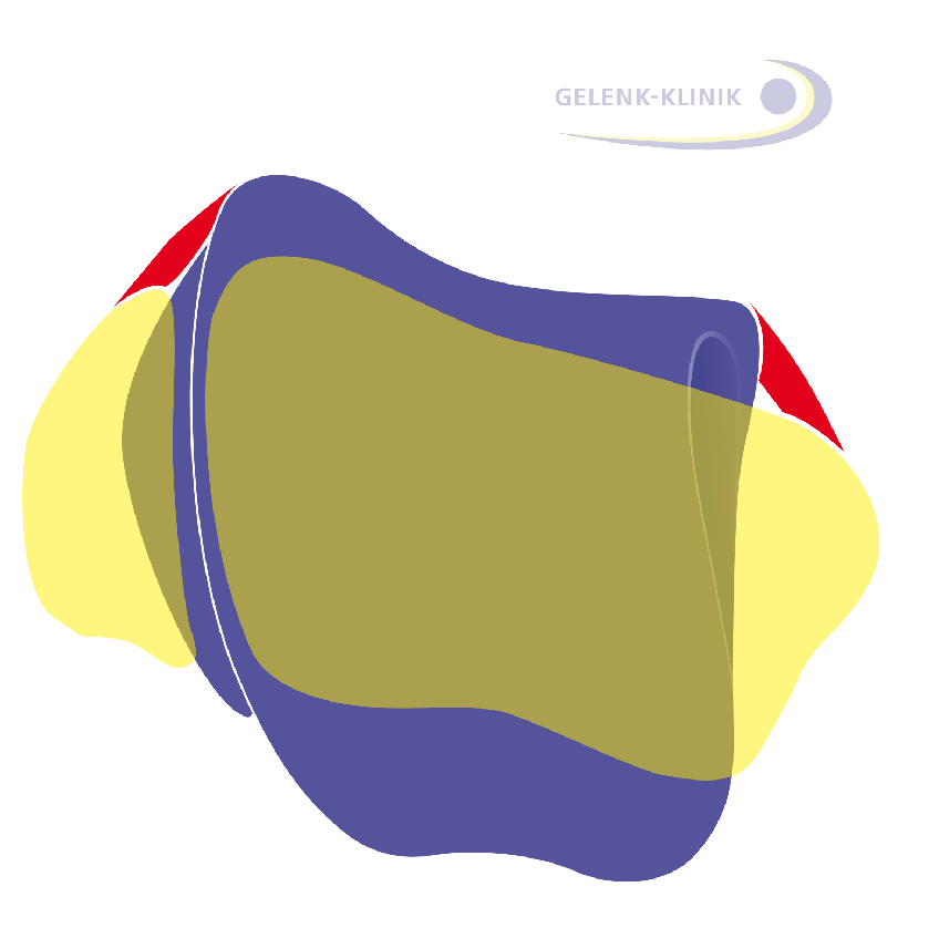 Die Lage des Talus (violett: Sprungbein, gelb links: Wadenbein; gelb rechts: Schienbein) wird durch die umgebenden Bänder des Sprunggelenks mitbestimmt. © www.fuss-sprunggelenk-akademie.de intakte Bänder des Sprunggelenks