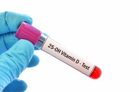 Zur Beurteilung des Vitamin-D-Status misst man 25(OH)D oder 25(OH)Vitamin D. Dabei handelt es sich um die Vorstufe des aktiven Vitamins, die im Blut zirkuliert oder in Muskel- und Fettgewebe gespeichert werden kann. © jarun011, Adobe Teströhrchen mit Blutprobe für die Vitamin-D-Bestimmung.