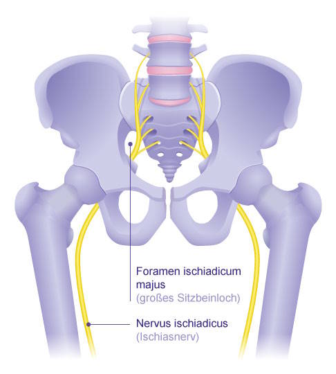 Der Ischiasnerv verläuft im Bereich des Beckens durch das Foramen ischiadicum majus und zieht dann in den Oberschenkel. © Gelenk-Klinik Anatomie des Ischiasnervs